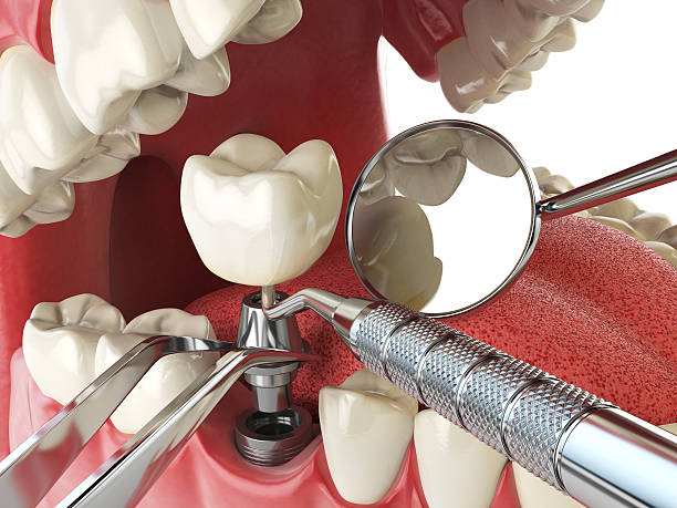 Best Emergency Gum Treatment in Haskell, OK