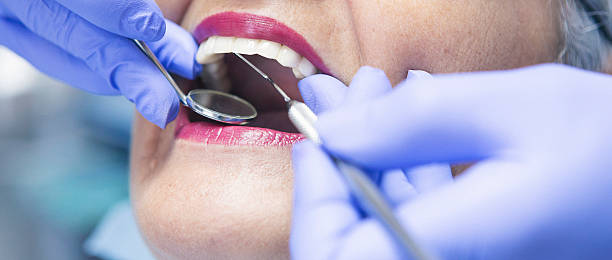 Best Emergency Wisdom Teeth Removal in Haskell, OK
